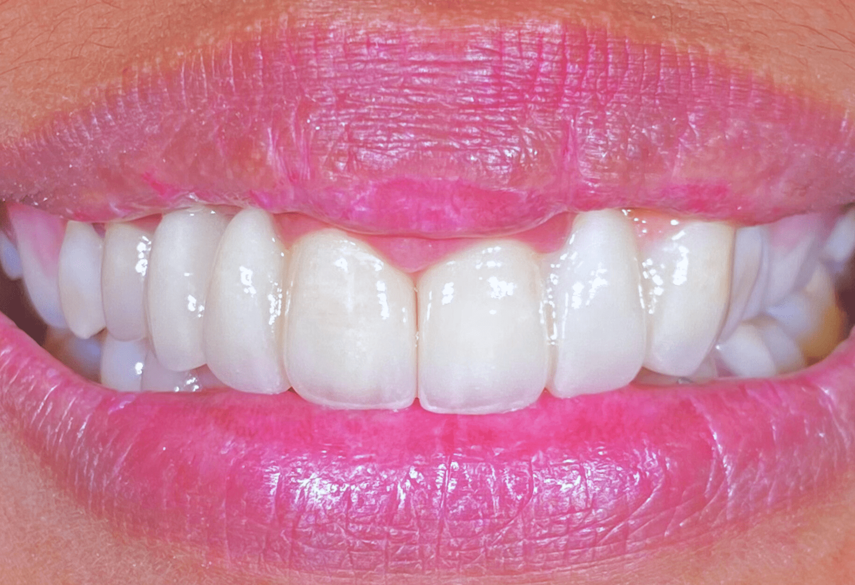 Best Dental Clinic and Dentist in Bali - Kalm Dental Care
