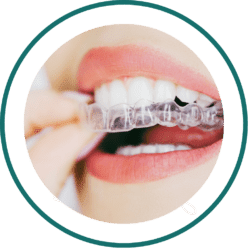 Bali Dentist Prices List